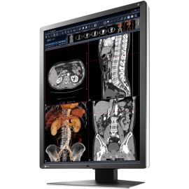 EIZO RadiForce RX250 22